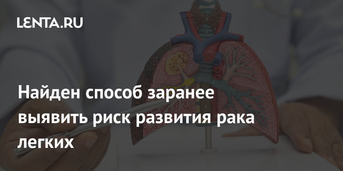 Найден способ заранее выявить риск развития рака легких