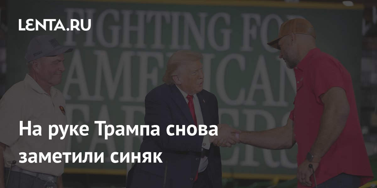 На руке Трампа снова заметили синяк