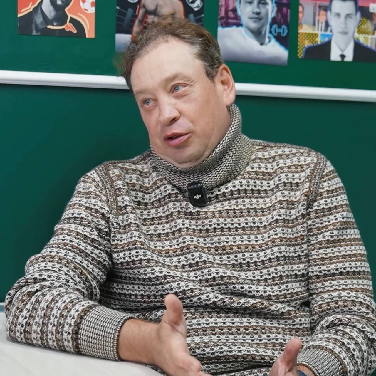 Слуцкий рассказал о пересадке волос в Турции