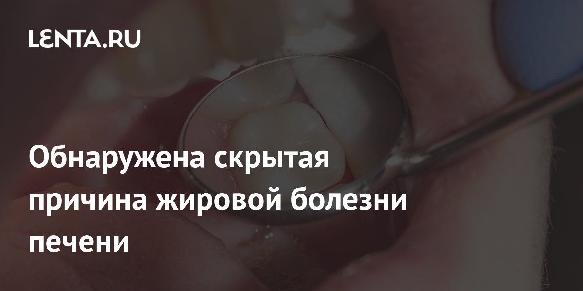 Обнаружена скрытая причина жировой болезни печени