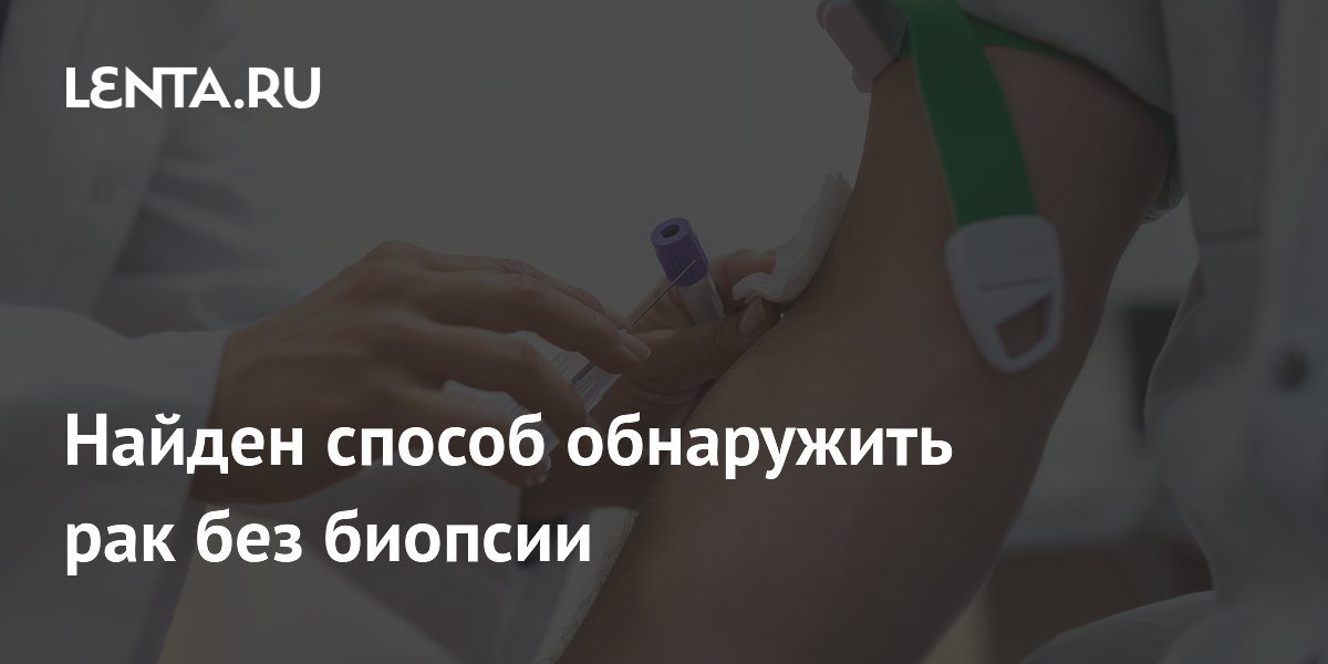 Найден способ обнаружить рак без биопсии