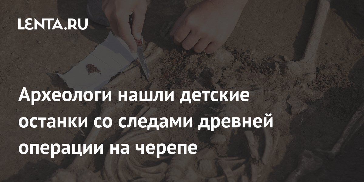 Археологи нашли детские останки со следами древней операции на черепе