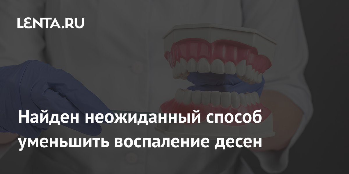 Найден неожиданный способ уменьшить воспаление десен