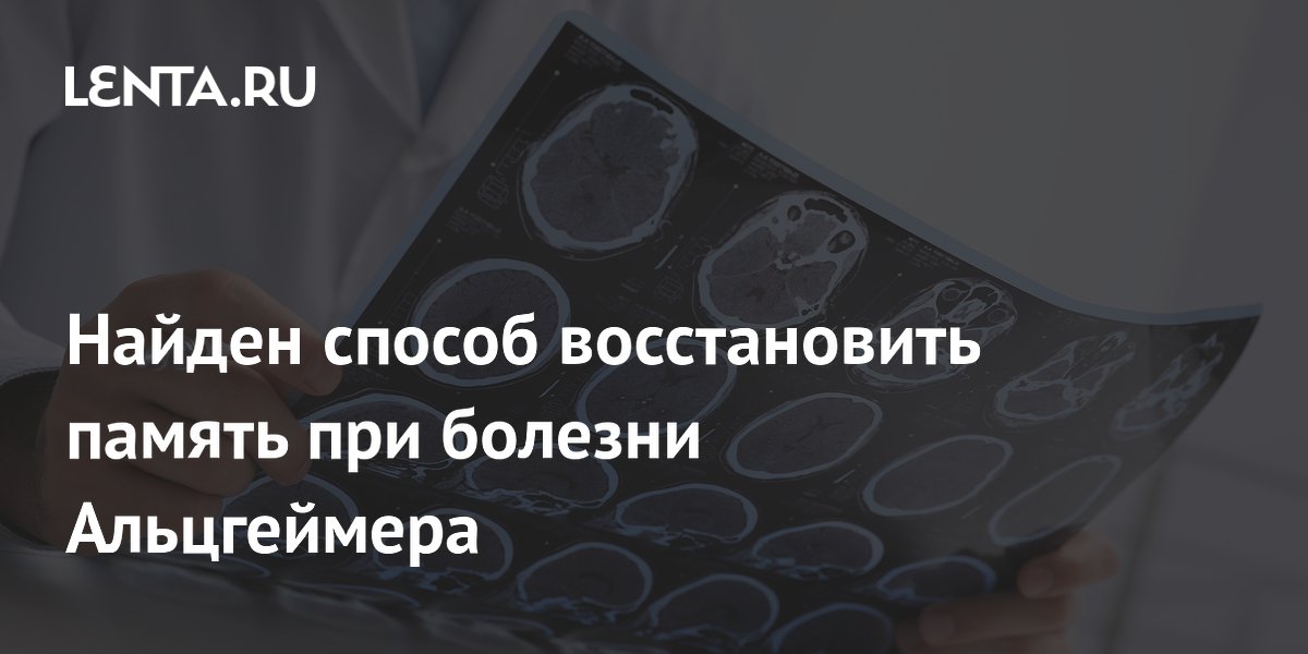 Найден способ восстановить память при болезни Альцгеймера