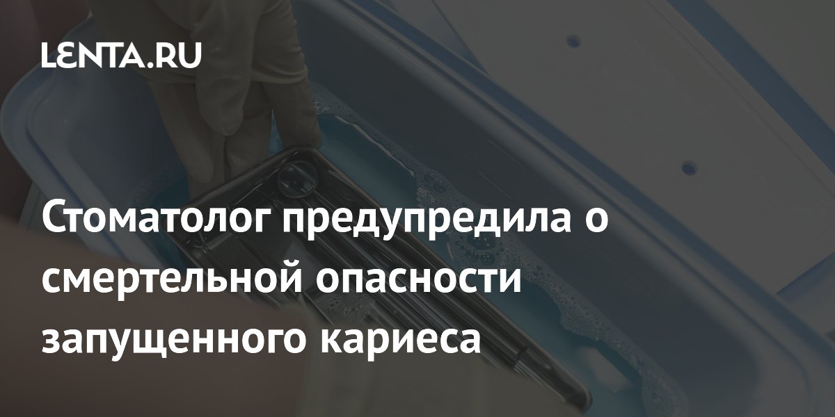 Стоматолог предупредила о смертельной опасности запущенного кариеса