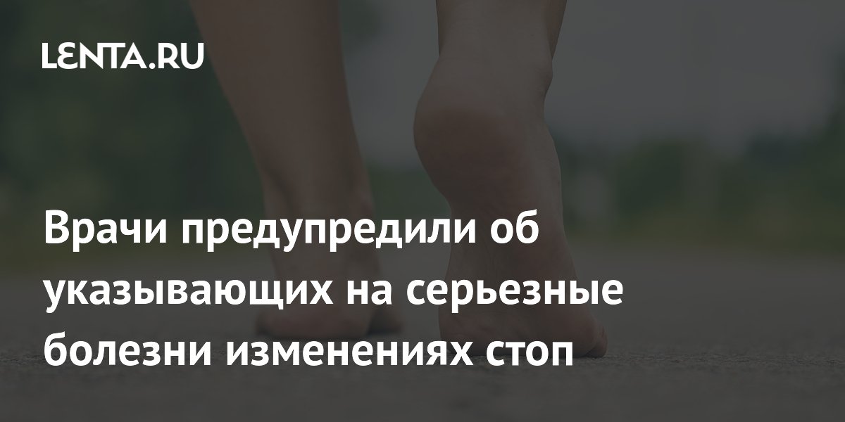Врачи предупредили об указывающих на серьезные болезни изменениях стоп