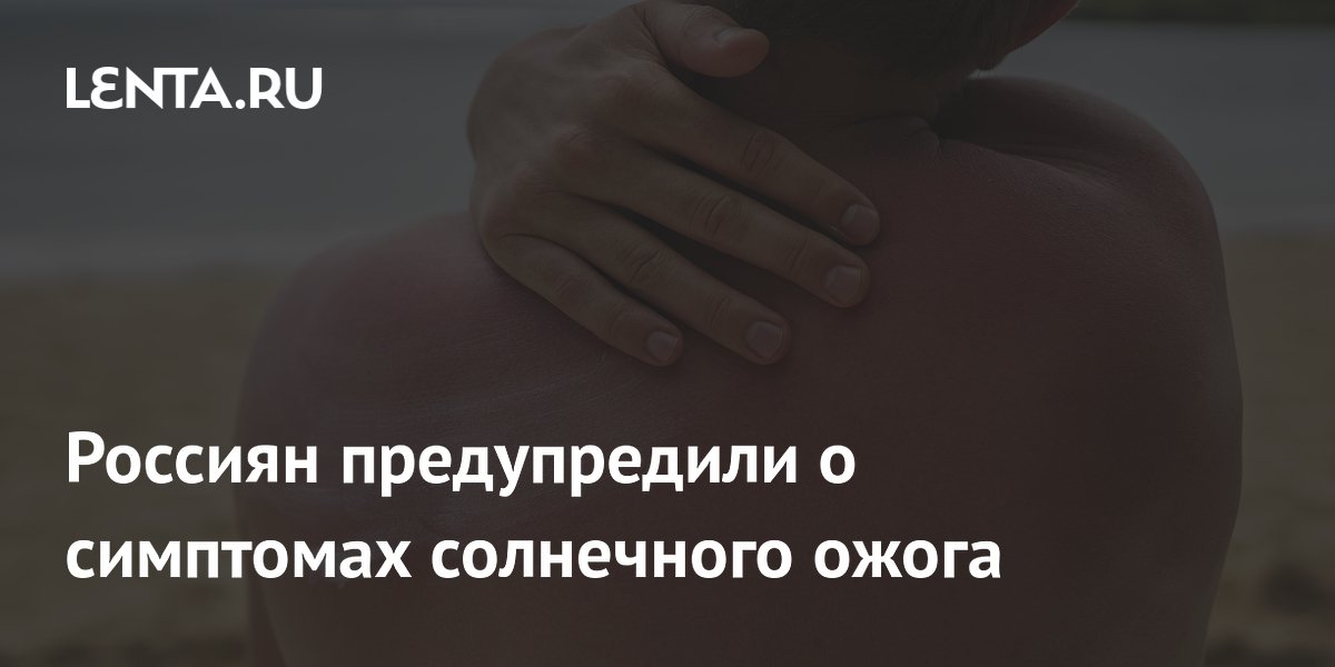 Россиян предупредили о симптомах солнечного ожога