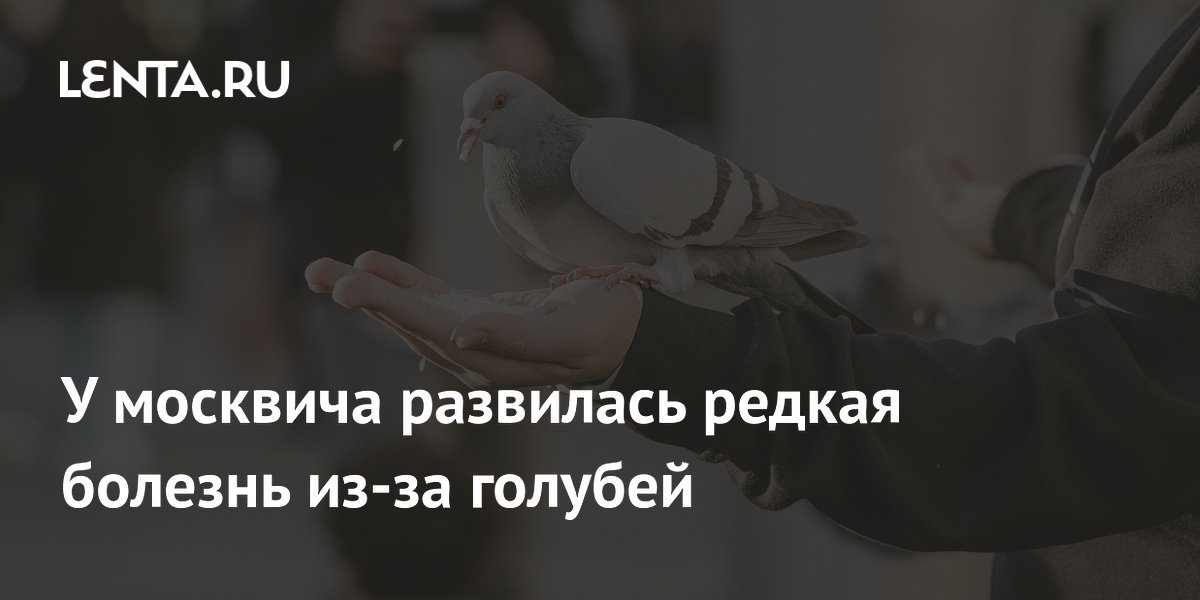 У москвича развилась редкая болезнь из-за голубей