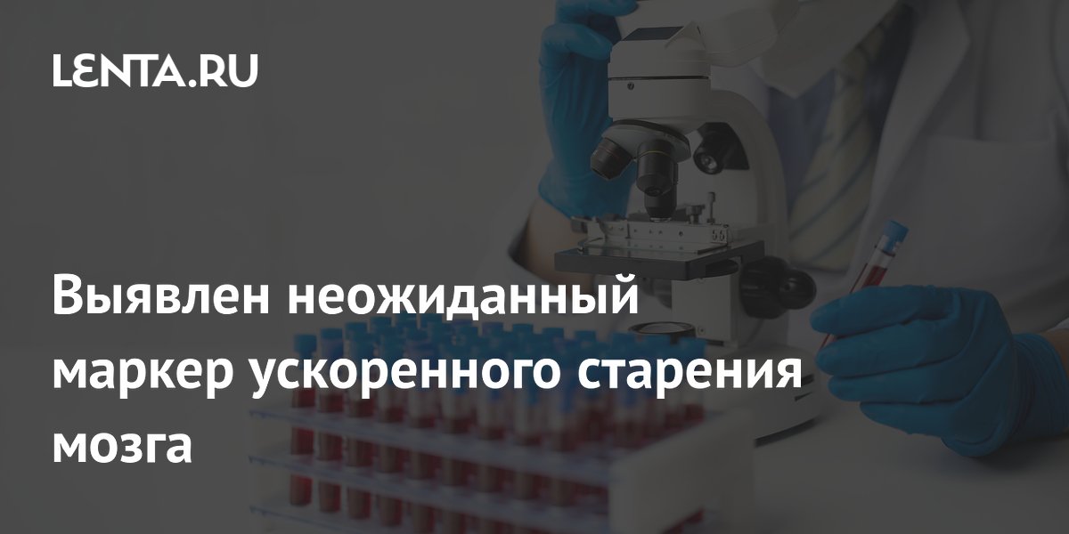 Выявлен неожиданный маркер ускоренного старения мозга
