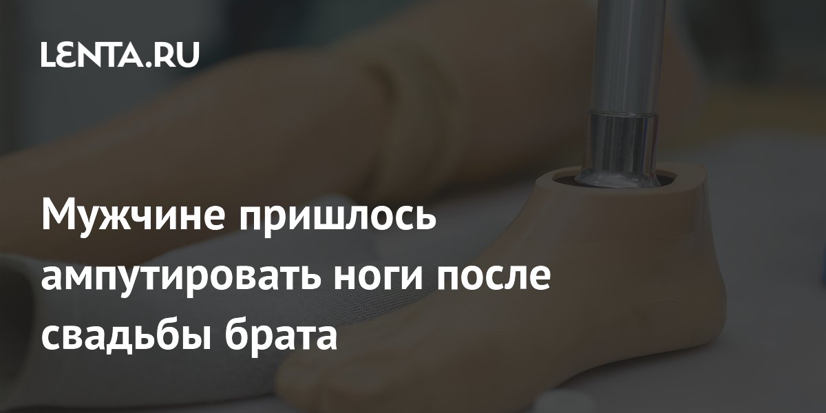 Мужчине пришлось ампутировать ноги после свадьбы брата