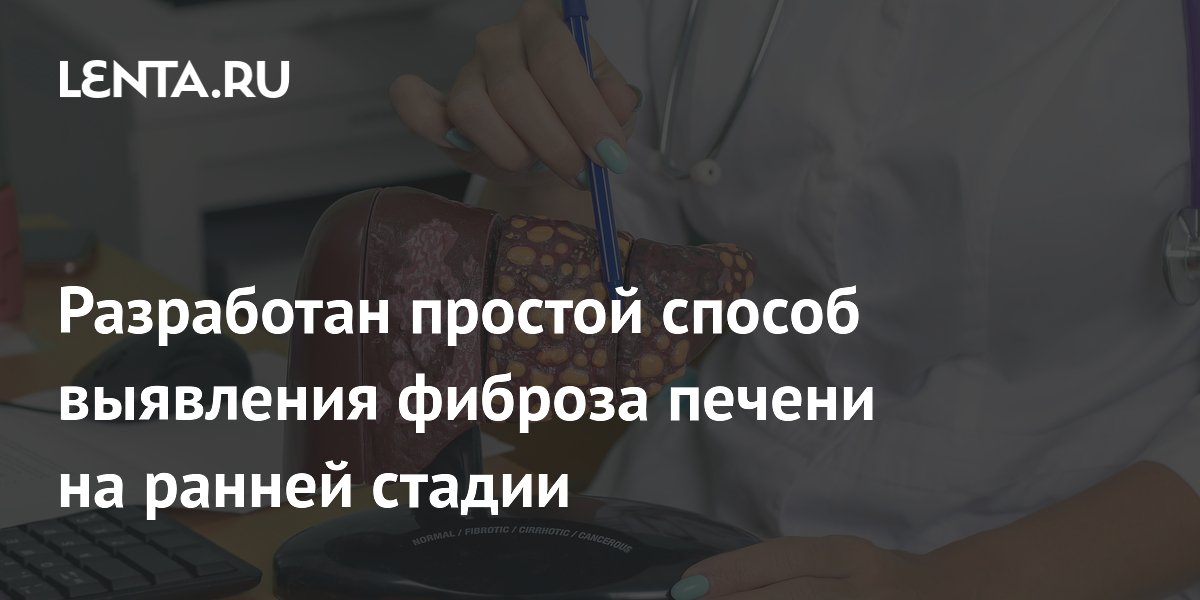 Разработан простой способ выявления фиброза печени на ранней стадии