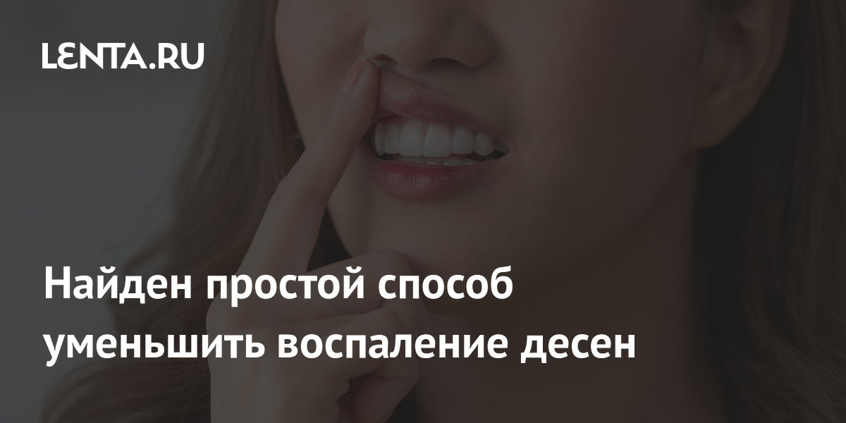 Найден простой способ уменьшить воспаление десен