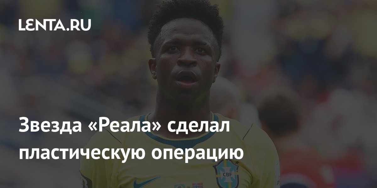 Звезда «Реала» сделал пластическую операцию
