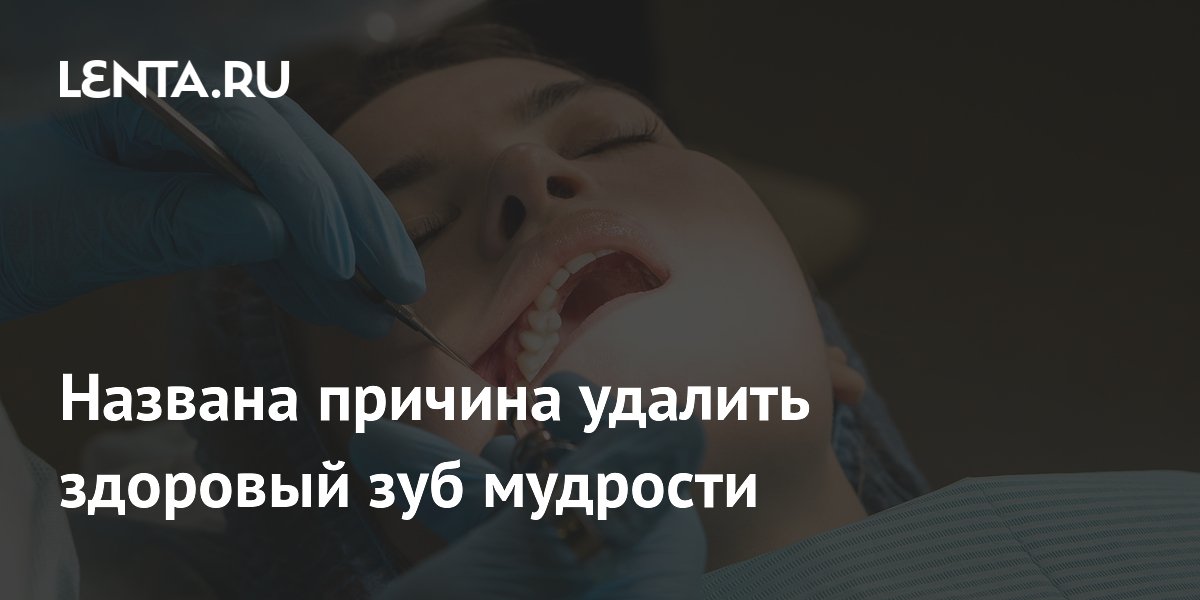 Названа причина удалить здоровый зуб мудрости