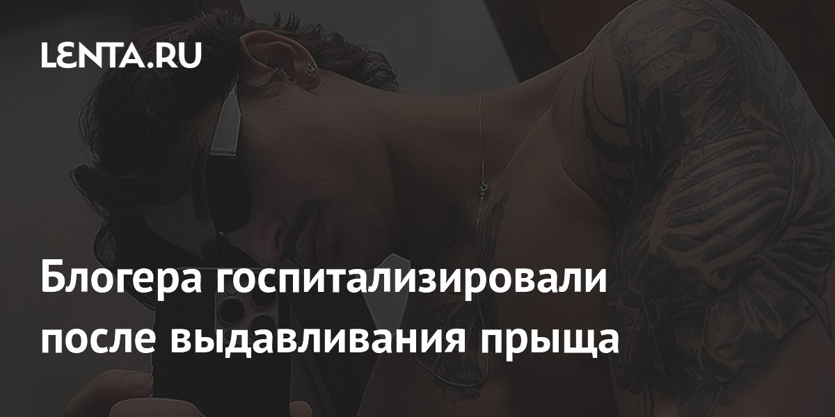 Блогера госпитализировали после выдавливания прыща