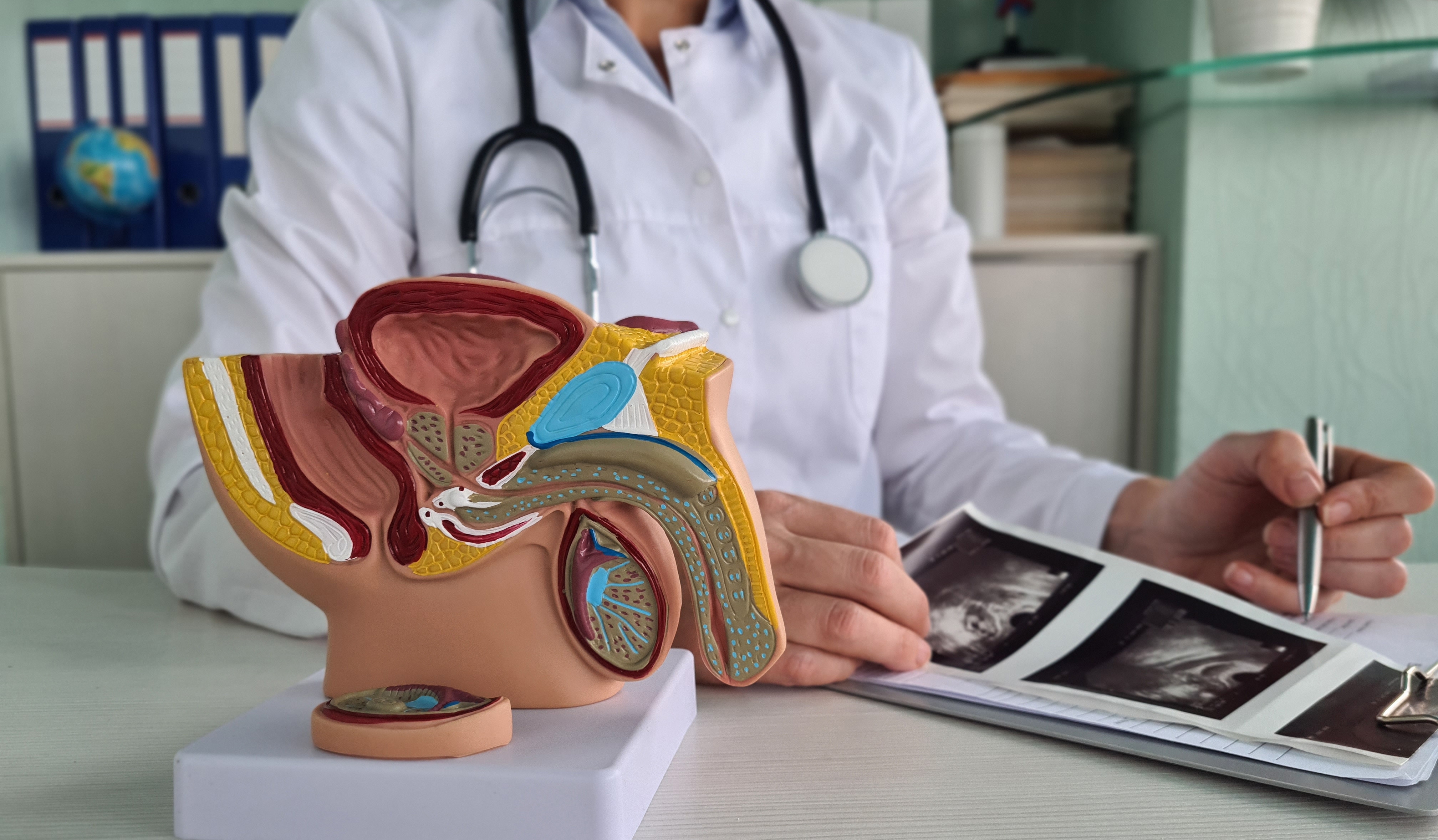 Doctor Names Early Warning Signs of Prostate Cancer