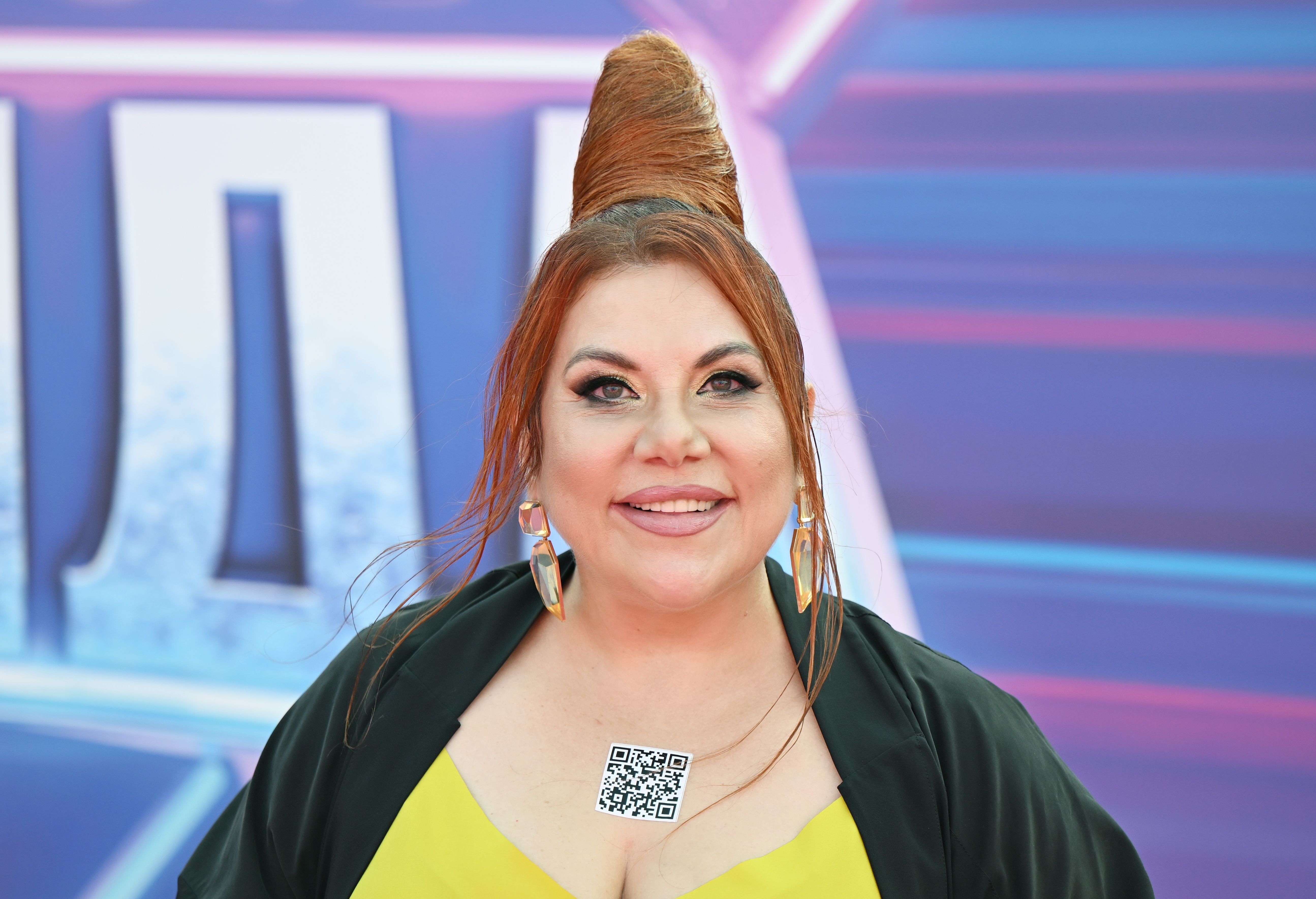 Marina Fedunkiv Reveals 19kg Weight Loss via Injections